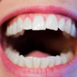 Prześliczne zdrowe zęby dodatkowo efektowny uroczy uśmieszek to powód do dumy.